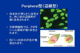 slide3